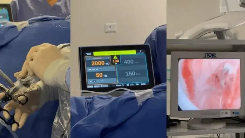 HU realiza 5 cirurgias inéditas de próstata a laser no SUS