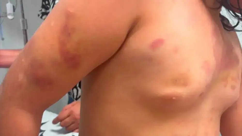 Mãe de autista agredida defende padrasto em áudio